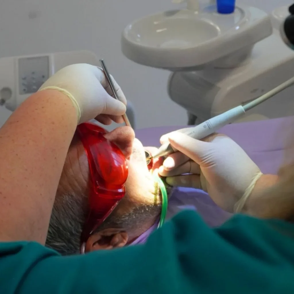 devitalizzazione dente a Siracusa e Pozzallo