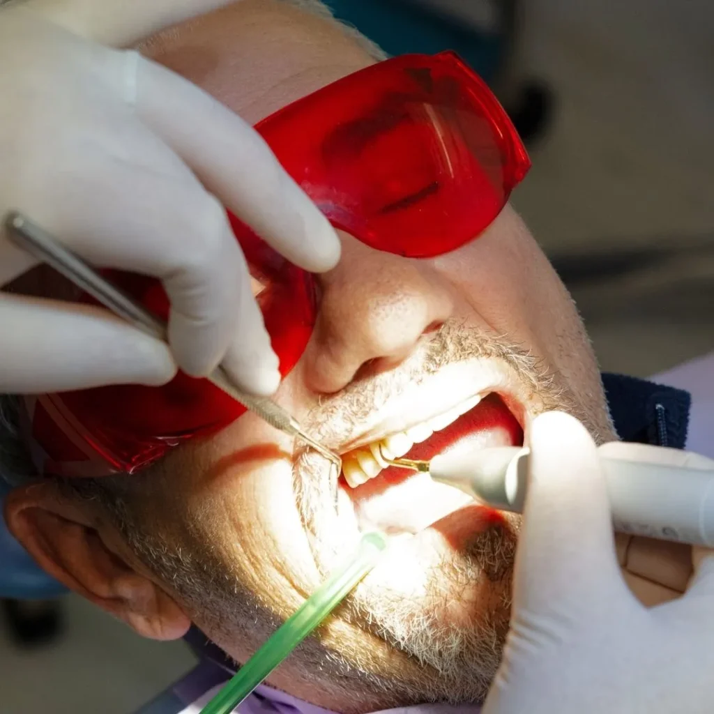 igiene dentale a Siracusa e Pozzallo