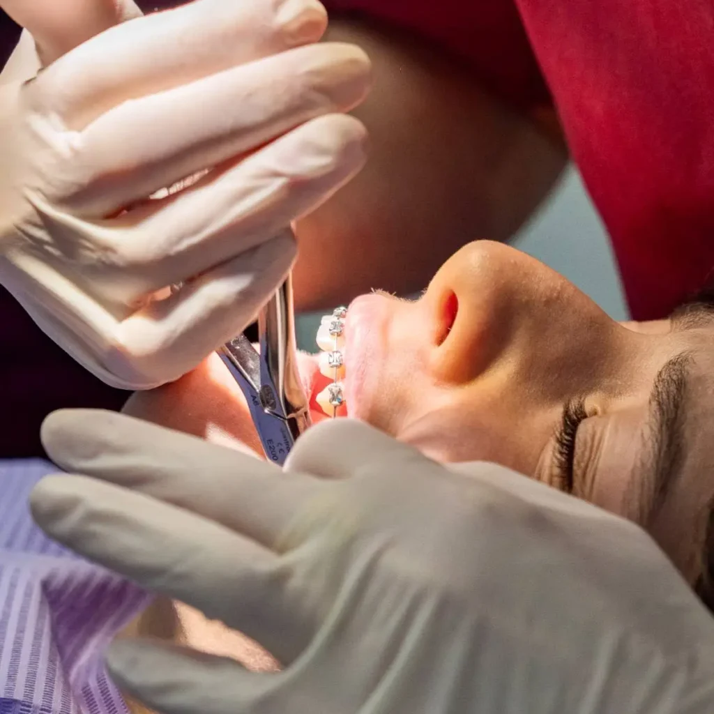 apparecchio dentale a Siracusa e Pozzallo
